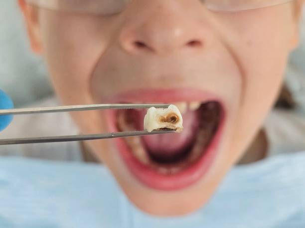 Best 24-Hour Emergency Dentist in Oyster Creek, TX