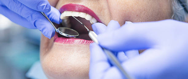 Best Emergency Treatment for Dental Infections or Abscesses in Oyster Creek, TX